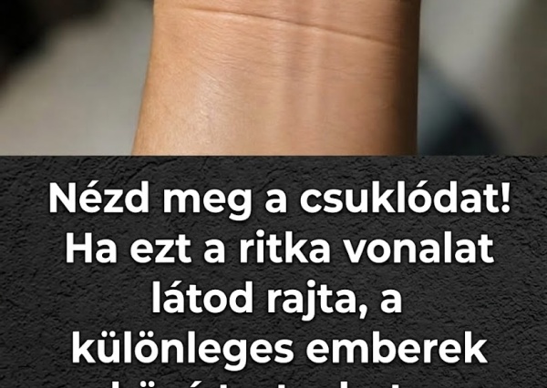 Nézd meg a csuklódat! Ha ezt a ritka vonalat látod rajta, a különleges emberek közé tartozhatsz