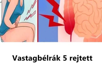 Vastagbélrák 5 rejtett tünete, amit jobb, ha ismersz!