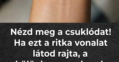Nézd meg a csuklódat! Ha ezt a ritka vonalat látod rajta, a különleges emberek közé tartozhatsz