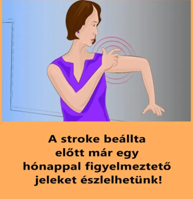 fs stroke