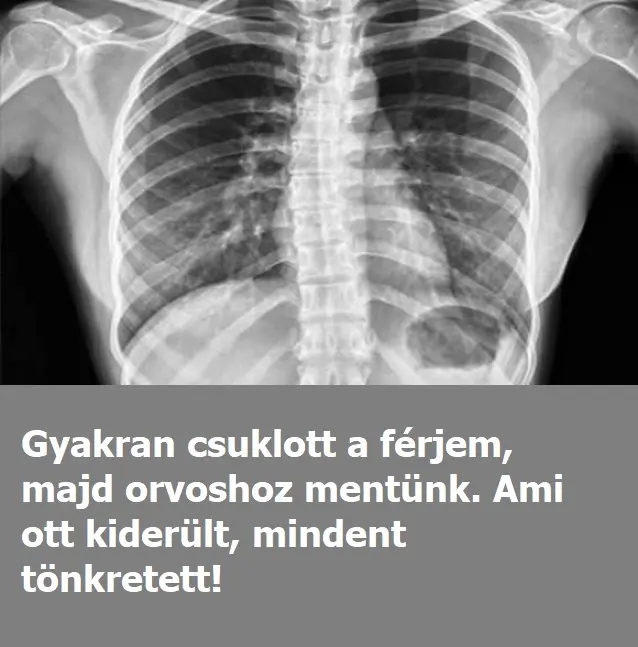 csuklas