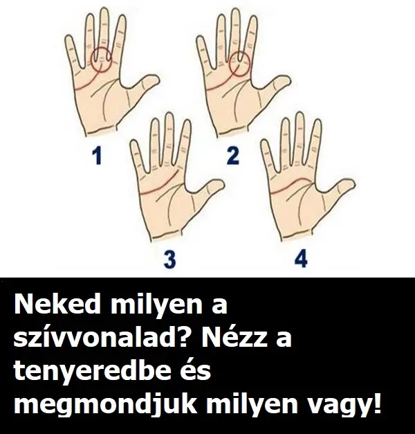 szivvonal